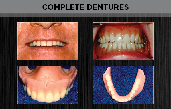 prosthodontics - dentures