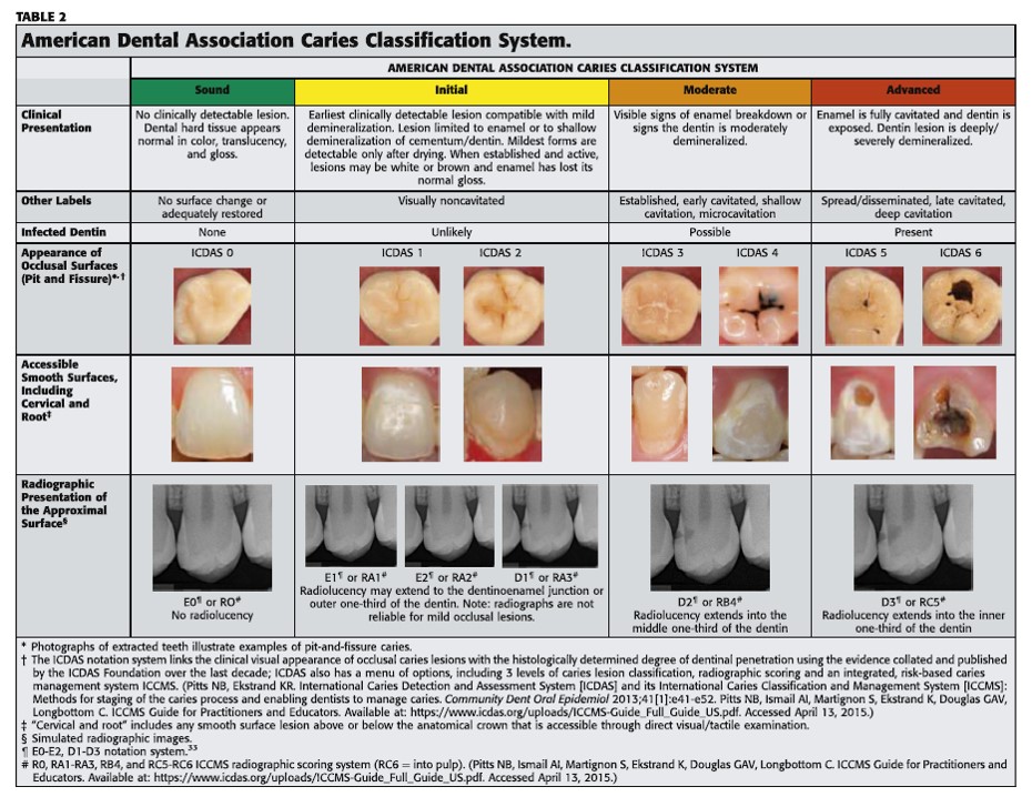 Icdas Chart