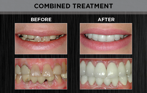 prosthodontics - combined
